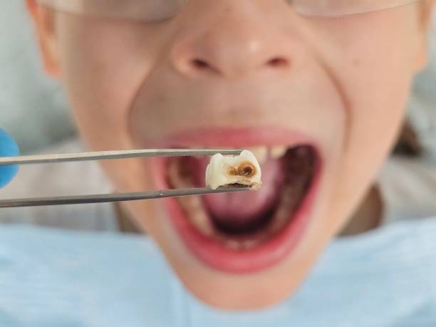 Best Emergency Orthodontic Repairs in Santa Rosa, CA