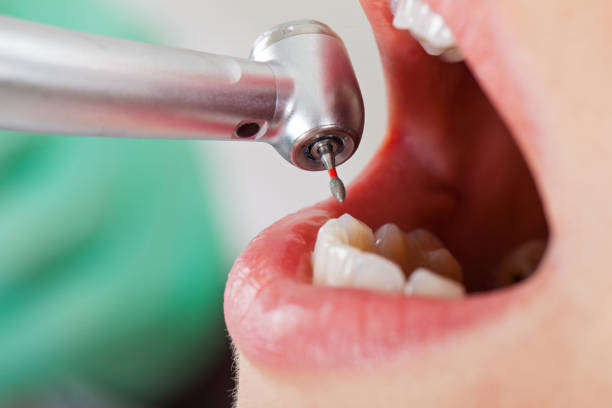 Best Emergency Pediatric Dental Care in Santa Rosa, CA